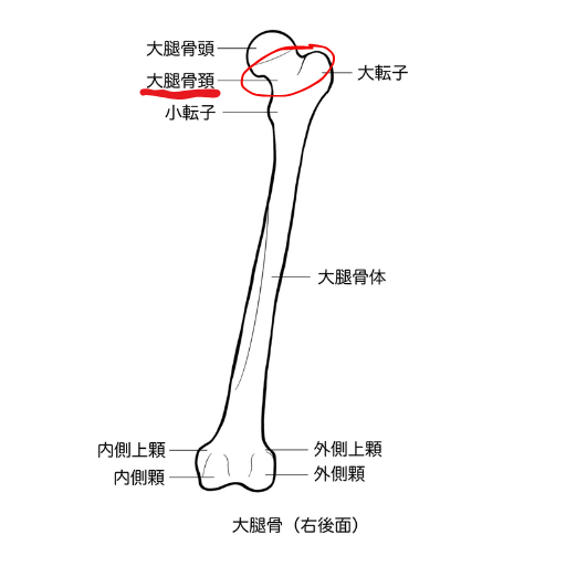 大腿骨のイラスト(マーカーあり)